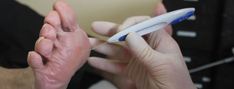 Footcare For People With Diabetes