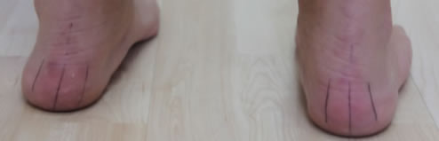 Biomechanical Assessment