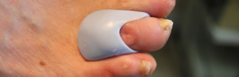 Provision of Moulded Silicones